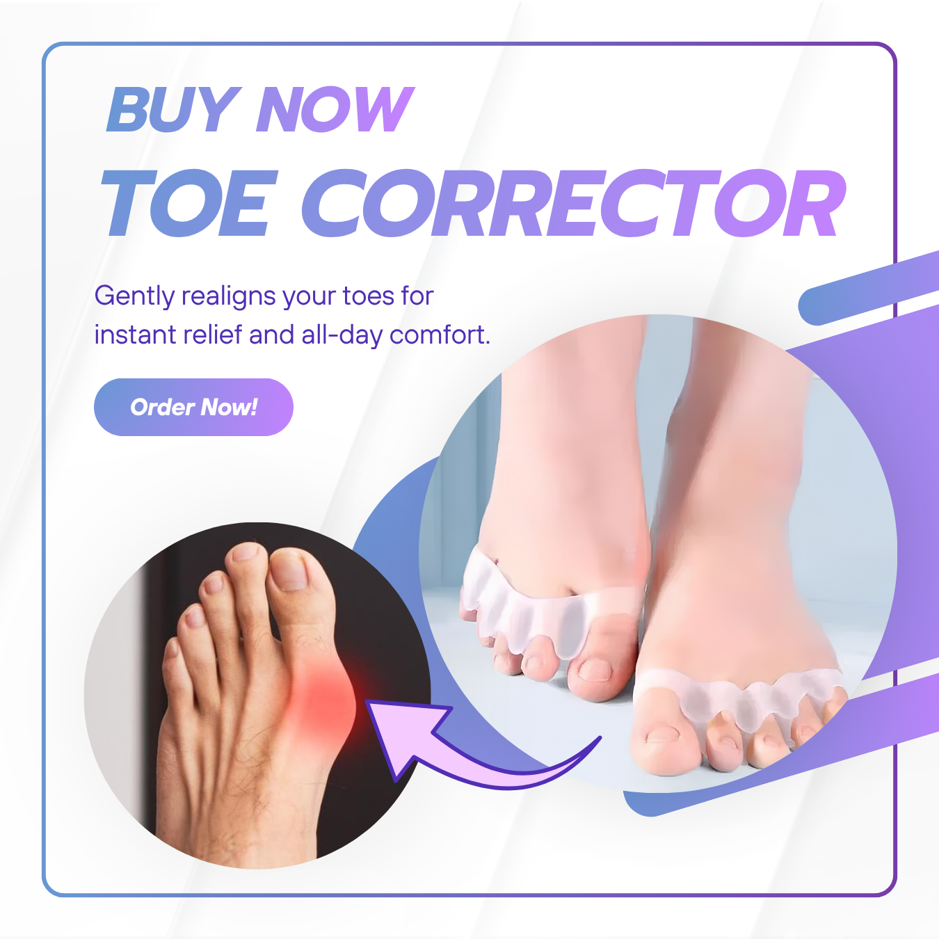 Professional Toe Corrector & Bunion Relief (Pair)