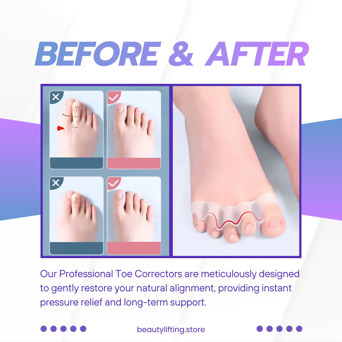 Professional Toe Corrector & Bunion Relief (Pair)